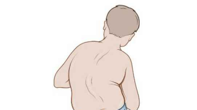 skolioza-Reha-MedicAL