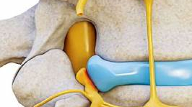 Sesedanje hrbtenice Reha Medical