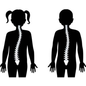SKOLIOZA PRI OTROKU - Reha Medical